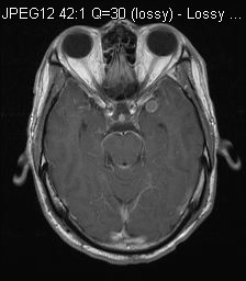 MRI Post - 3